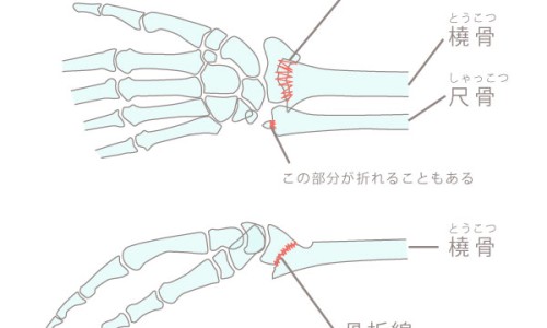 京东网上冰箱和实体的区别-京东上的冰箱质量可靠吗、买冰箱京东还是实体店 -京东冰箱和商场区别网